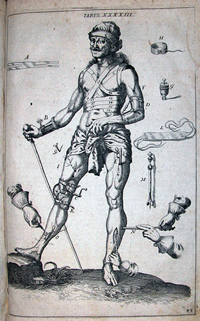 Scultetus, Johannes, 1595-1645 
