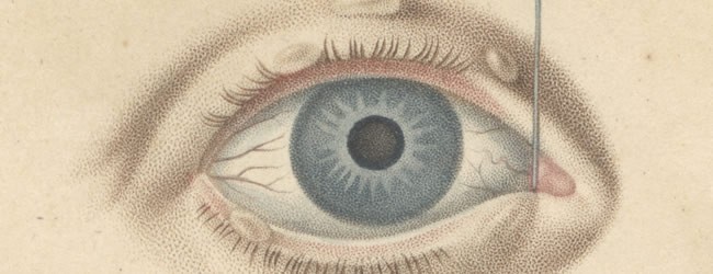 Demours, Antoine Pierre, 1762-1836