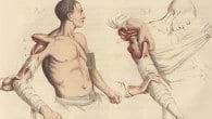 John Martin Rare Book Room Images Illustrations on anatomy, physiology, and surgery, dating from the 1500s